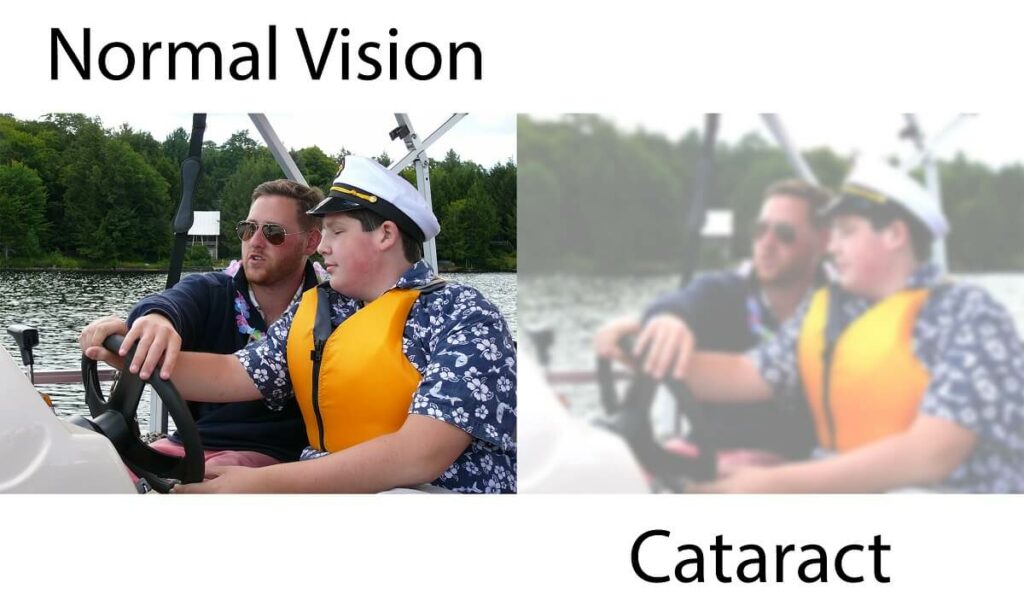 Two images intended to be identical as a side by side comparison of normal vision compared to the blurred vision of cataracts