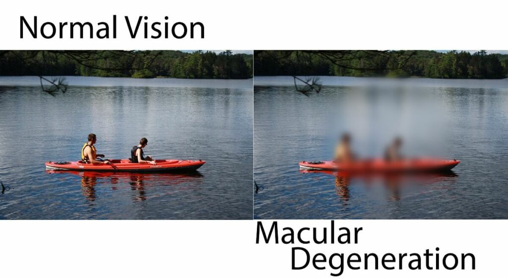 Two images intended to be identical as a side by side comparison of normal vision compared to the vision with macular degeneration