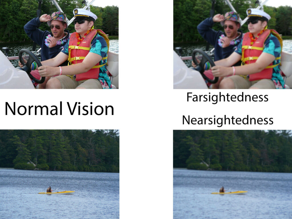 Comparison of normal vision and farsightedness and nearsightedness